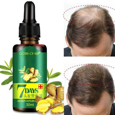 Intense Hair Growth oil