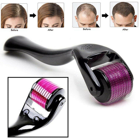 Derma Roller 0.5mm with 540 Titanium Alloy Needles.For Hair Growth - Elevate Scalp Health and Transform Your Hair