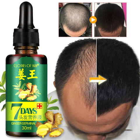 Derma Roller + Ginger Hair Growth  Oil (2 in 1)